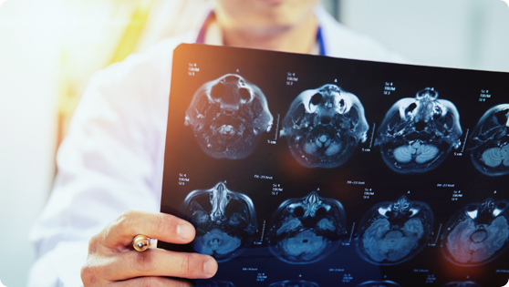 Neurology Treatments